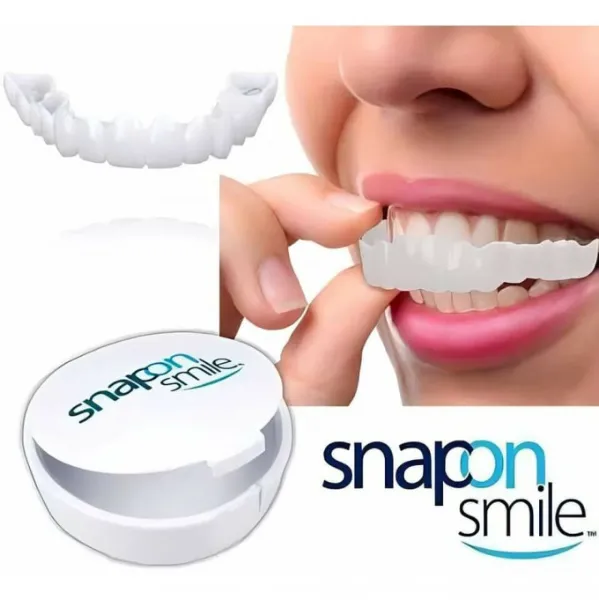 الاصلي احدرو التقليد PERFECT SNAPON SMILE - Image 1