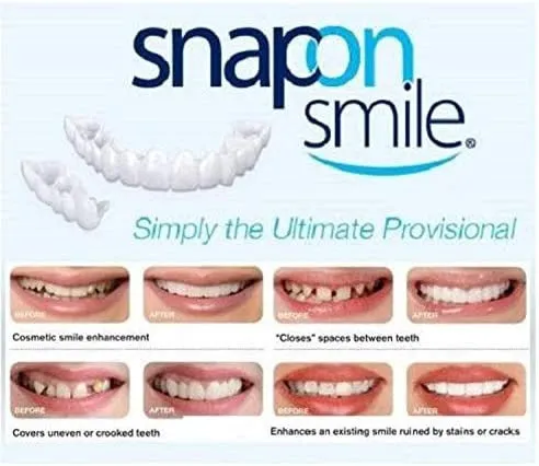 الاصلي احدرو التقليد PERFECT SNAPON SMILE - Image 5