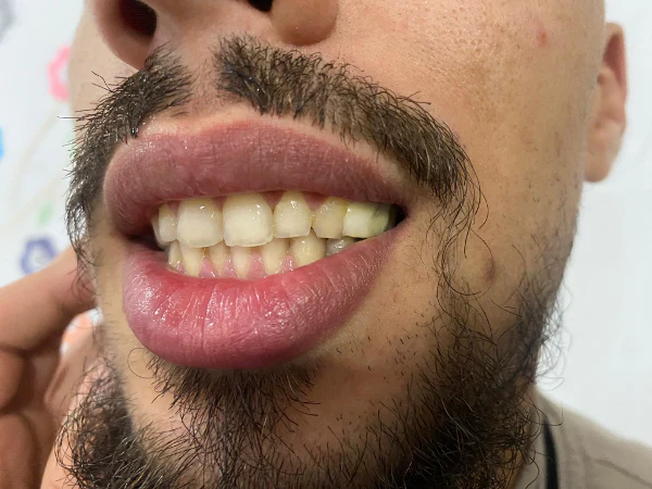 منتج فراغات الأسنان - Image 4