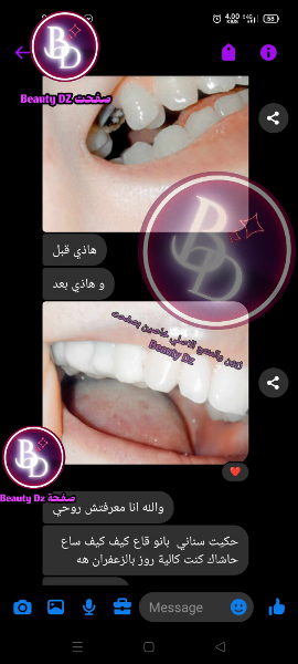 عجينة صنع الاسنان promotions livraison gratuite   - Image 3