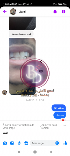 عجينة صنع الاسنان promotions livraison gratuite   - Image 5