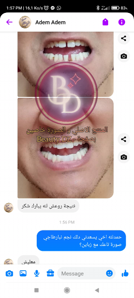 عجينة صنع الاسنان promotions livraison gratuite   - Image 6
