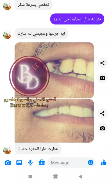 عجينة صنع الاسنان promotions livraison gratuite   - Image 7