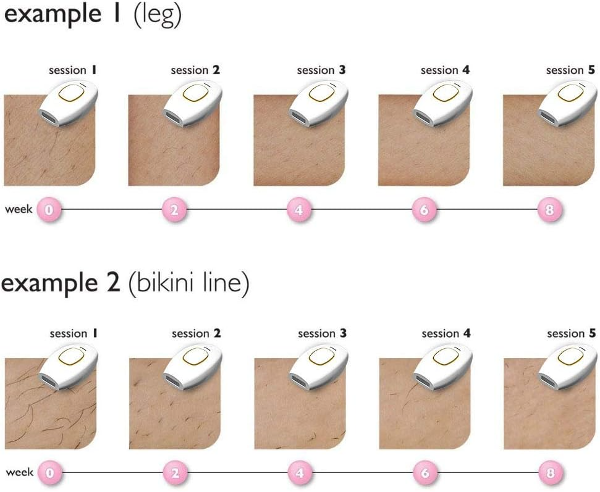 جهاز الليزر للشعر - Image 3
