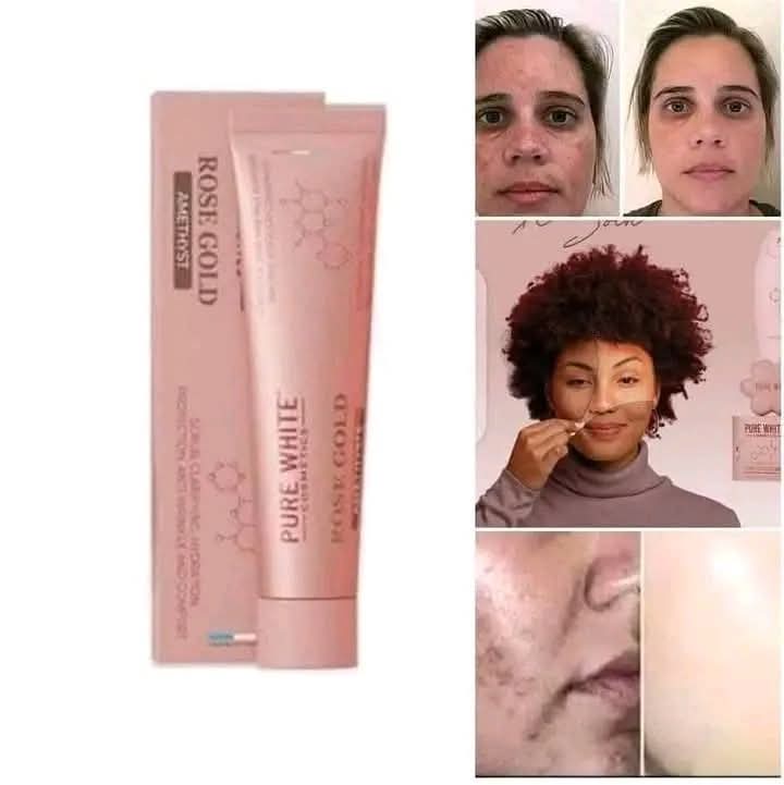 pure whithe gold rose تخفيض 50 بالمئة +هدية - Image 1