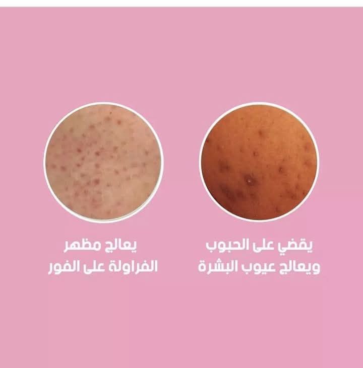 مقشر الجسم الفعال واللطيف على البشرة. - Image 5