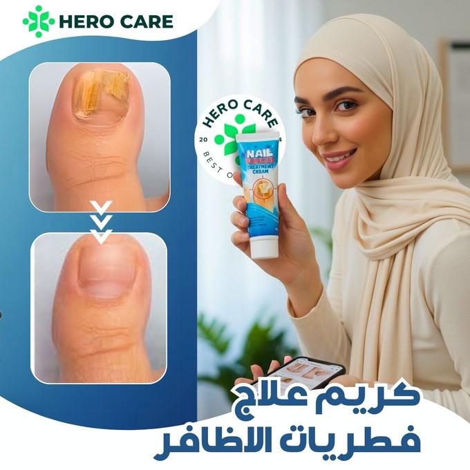 كريم علاج فطريات الأظافر - Image 1